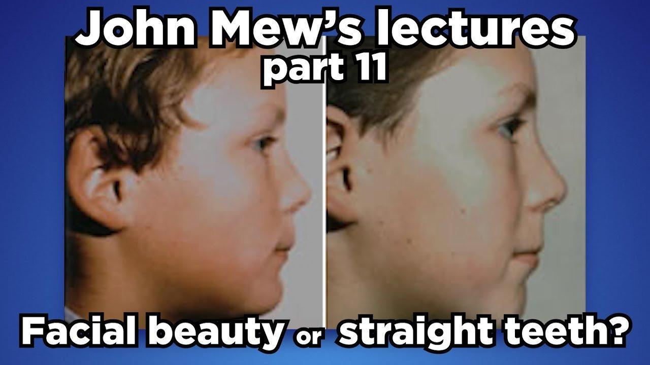 John-Mews-lectures-part-11-Facial-beauty-or-straight-teeth