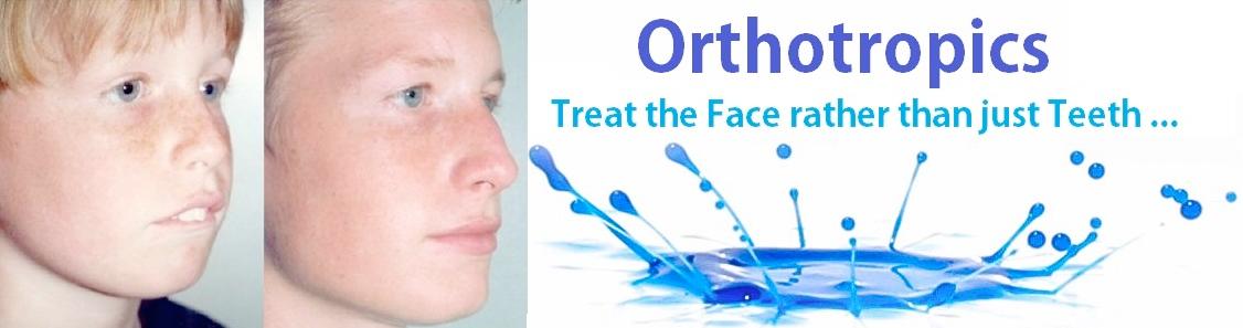 Orthotropics-Orthodontic-treat-Face-and-Teeth20