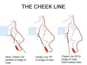 The-Cheek-Line-300x225