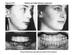 5-Aesthetics-300x225