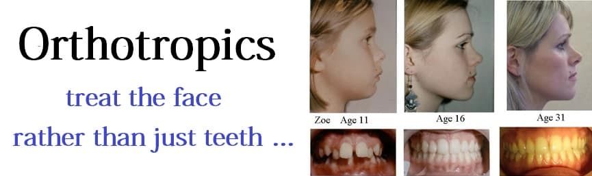 Orthotropics-orthodontic-treat-face-and-align-teeth22