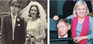 Stephen Hawking and Wife, Teeth before and After