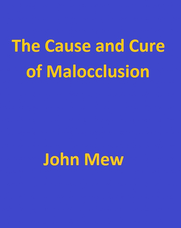 The Cause and Cure of Malocclusion by Prof. John Mew Book